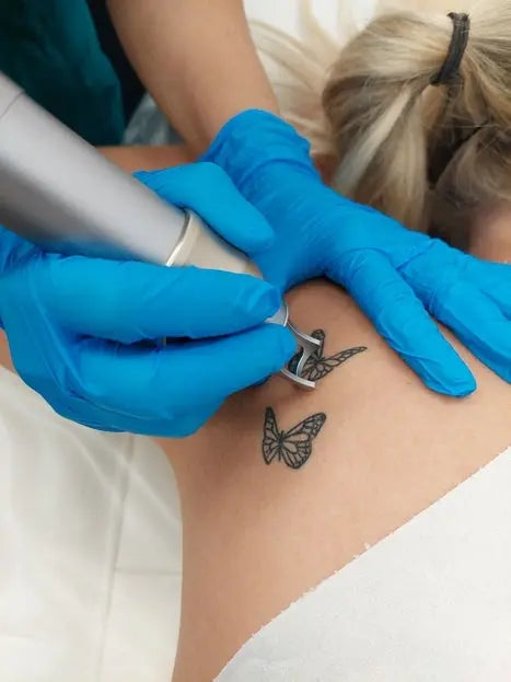 Unlocking the Secrets of Picosecond Laser Machines: A Game-Changer in Skin Treatment