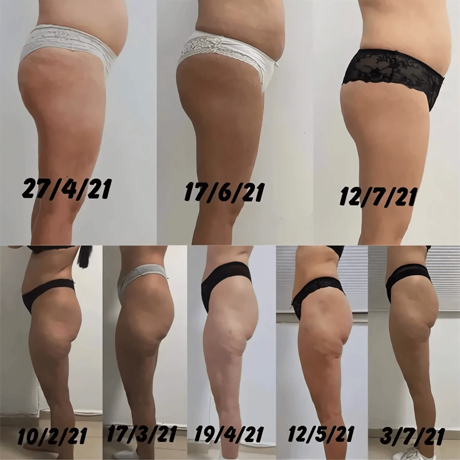 MINI 7 Tesla EMS body sculpting Machine with RF hongruibeauty