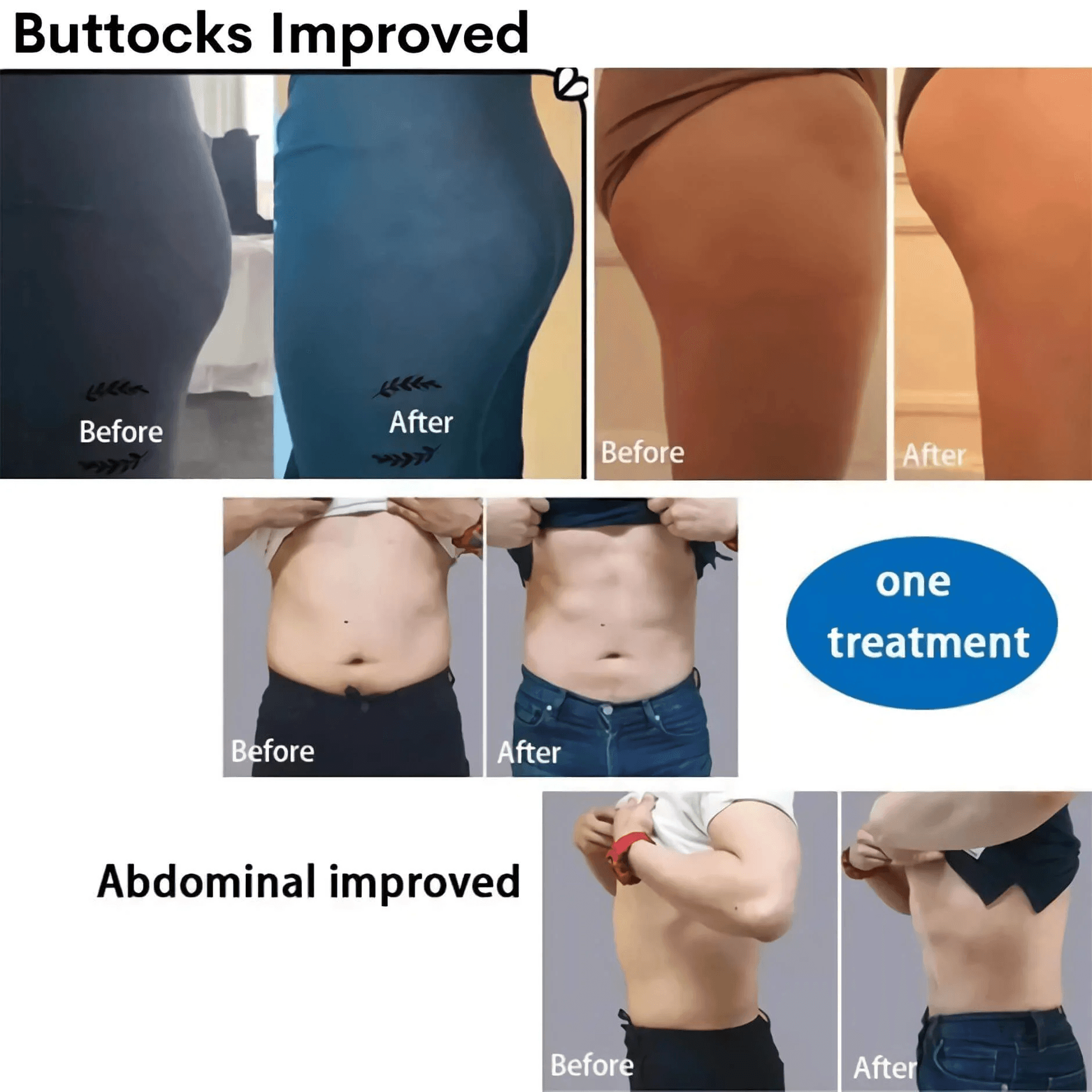 MINI 7 Tesla EMS body sculpting Machine with RF hongruibeauty