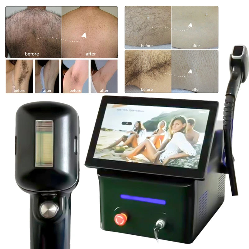 Portable 808nm Diode Laser Hair Removal Machine with 755/808/1064nm Triple Wavelength Cooling System