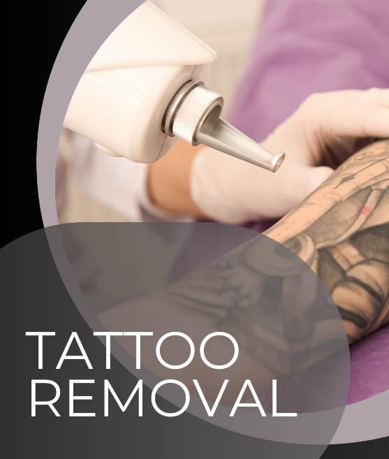Unraveling the Secrets of Laser Tattoo Removal: Exploring Different Wavelengths
