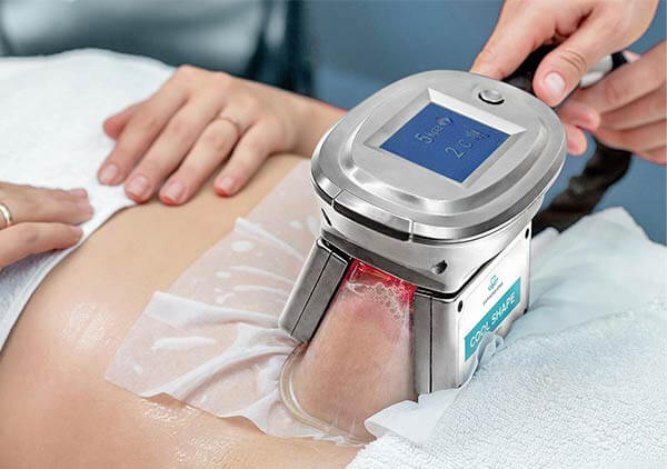The Ultimate Guide to Cryolipolysis: Freeze Away Stubborn Fat Effortlessly