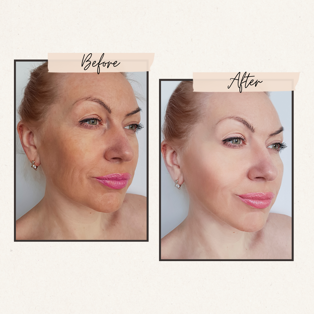 Oxygen Infusion Beauty Machine – Deep Hydration, Instant Glow, Ageless Skin!