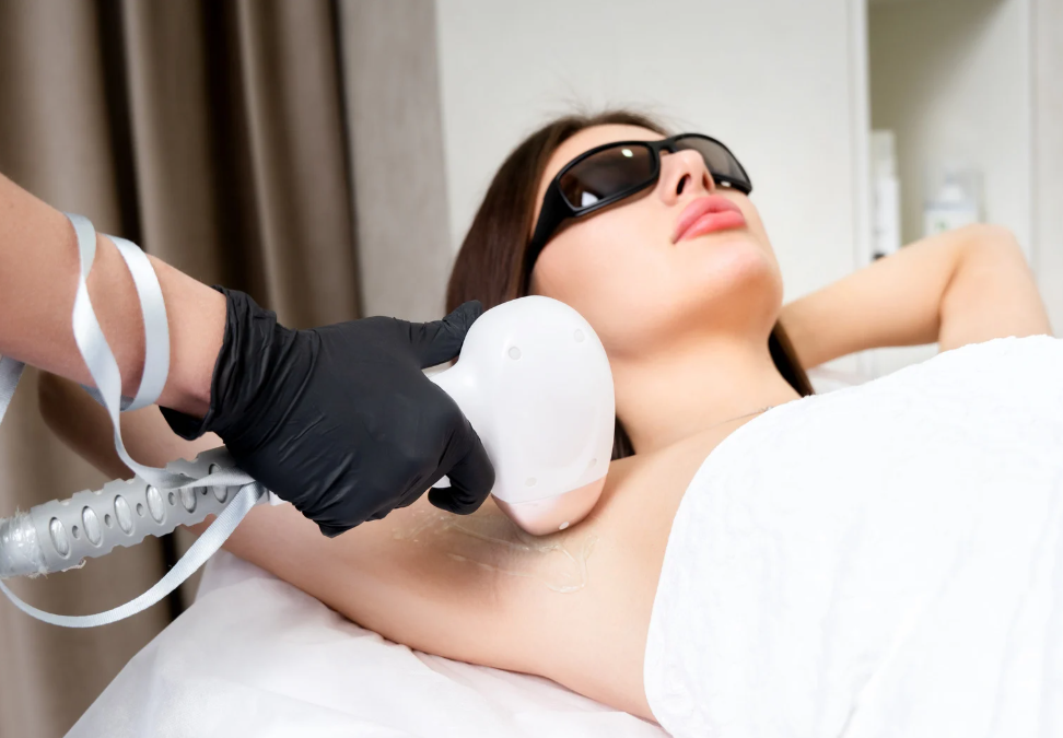 Unlock Smooth, Hair-Free Skin with 808nm Diode Laser Hair Removal