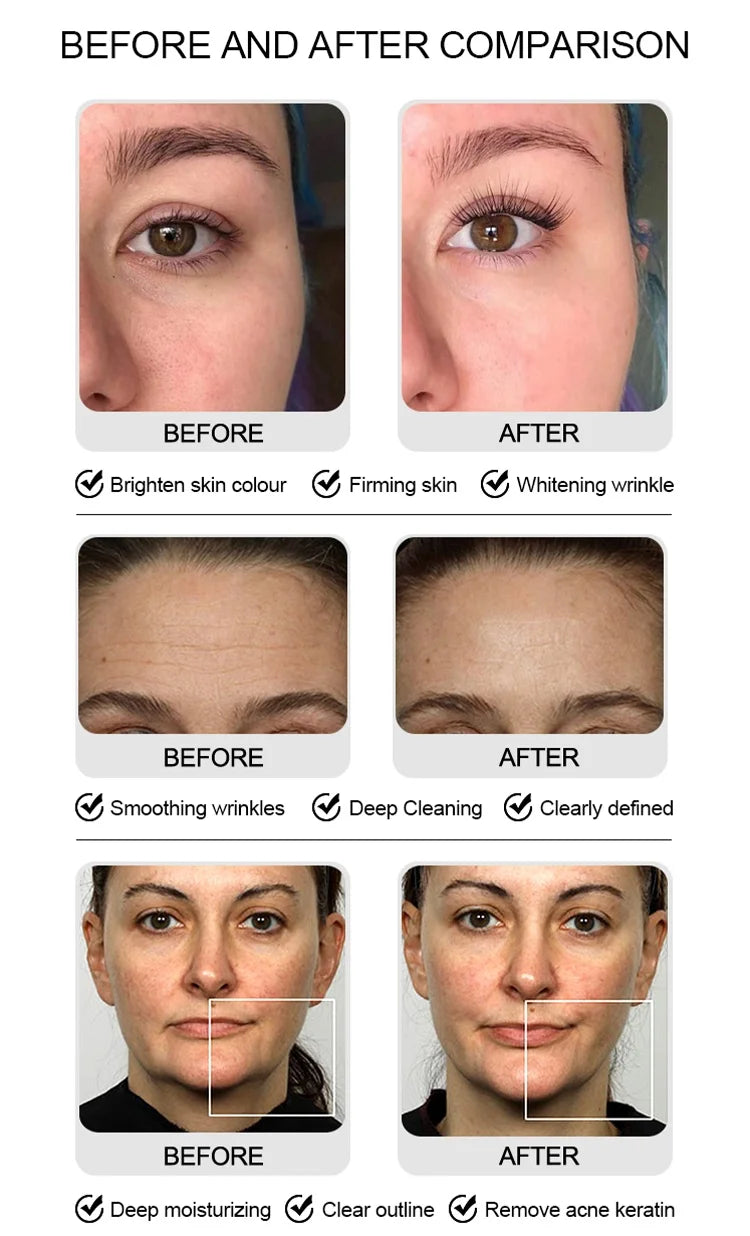 Portable hydradermabrasion Machine for Facial Cleaning Skin Rejuvenation Oxygen Dermabrasion Jet Peeling